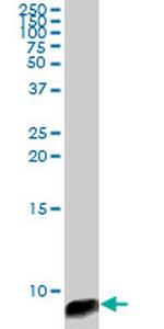 ATOX1 Antibody in Western Blot (WB)