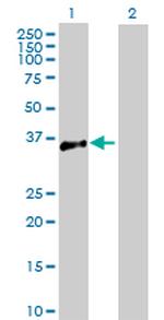 ATP1B3 Antibody in Western Blot (WB)