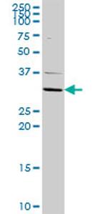 ATP4B Antibody in Western Blot (WB)