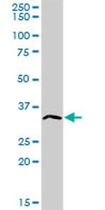 ATP4B Antibody in Western Blot (WB)