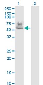 ATP6V1A Antibody in Western Blot (WB)