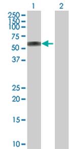 ATP6AP1 Antibody in Western Blot (WB)