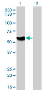 ATP6AP1 Antibody in Western Blot (WB)