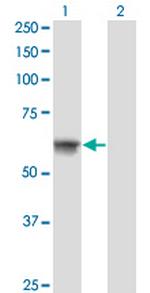 ATP6AP1 Antibody in Western Blot (WB)