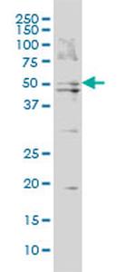 BAAT Antibody in Western Blot (WB)