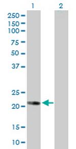 BAD Antibody in Western Blot (WB)