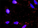 BAD Antibody in Proximity Ligation Assay (PLA) (PLA)