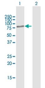 BBS2 Antibody in Western Blot (WB)