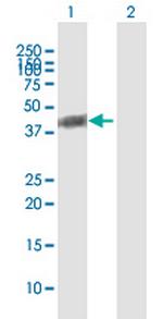 BCKDHA Antibody in Western Blot (WB)