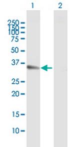 CCND1 Antibody in Western Blot (WB)