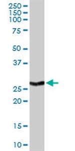 BCL2L1 Antibody in Western Blot (WB)