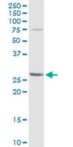 BCL2L1 Antibody in Western Blot (WB)