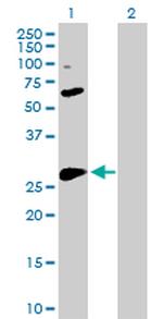 BCL2L1 Antibody in Western Blot (WB)