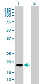 TNFRSF17 Antibody in Western Blot (WB)