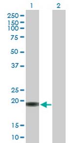 TNFRSF17 Antibody in Western Blot (WB)