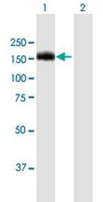 BCR Antibody in Western Blot (WB)