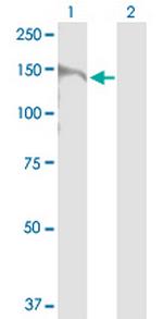 BCR Antibody in Western Blot (WB)