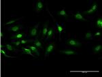 BCR Antibody in Immunocytochemistry (ICC/IF)