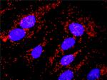 BCR Antibody in Proximity Ligation Assay (PLA) (PLA)