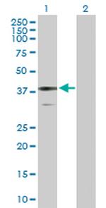 BDH1 Antibody in Western Blot (WB)