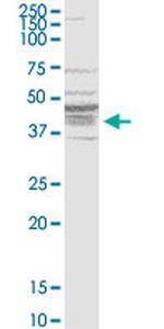 BDKRB1 Antibody in Western Blot (WB)