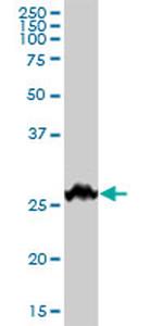 BDNF Antibody in Western Blot (WB)