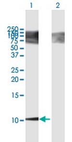 BGLAP Antibody in Western Blot (WB)