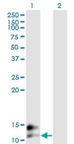 BGLAP Antibody in Western Blot (WB)