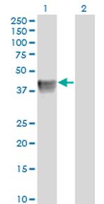 BGN Antibody in Western Blot (WB)