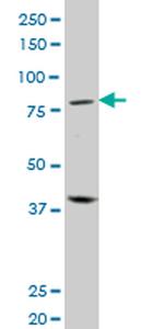 PRDM1 Antibody in Western Blot (WB)