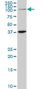 PRDM1 Antibody in Western Blot (WB)