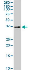 BLVRA Antibody in Western Blot (WB)