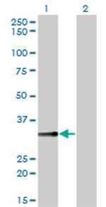 BLVRA Antibody in Western Blot (WB)