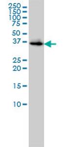 BLVRA Antibody in Western Blot (WB)