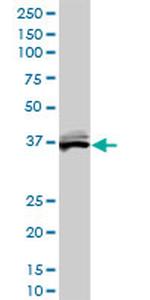 BLVRA Antibody in Western Blot (WB)