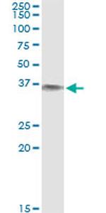 BLVRA Antibody in Immunoprecipitation (IP)