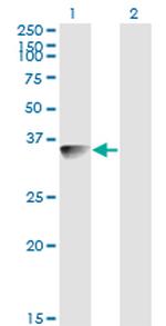 BLVRA Antibody in Western Blot (WB)