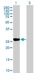 BNIP1 Antibody in Western Blot (WB)