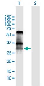 BNIP3 Antibody in Western Blot (WB)