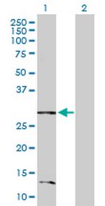 BNIP3L Antibody in Western Blot (WB)