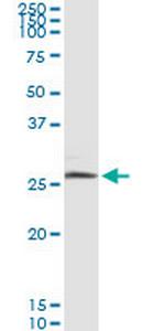 BNIP3L Antibody in Immunoprecipitation (IP)