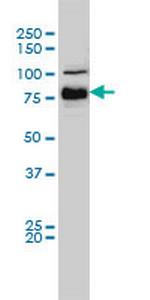 BRAF Antibody in Western Blot (WB)