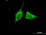 BRAF Antibody in Immunocytochemistry (ICC/IF)