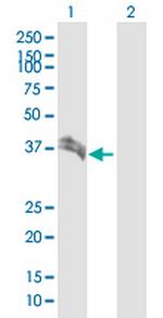 BST1 Antibody in Western Blot (WB)