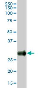 BST2 Antibody in Western Blot (WB)