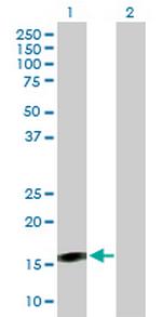 BST2 Antibody in Western Blot (WB)