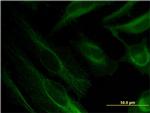 BST2 Antibody in Immunocytochemistry (ICC/IF)