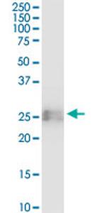 BST2 Antibody in Western Blot (WB)