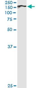 BUB1 Antibody in Immunoprecipitation (IP)