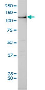 BUB1 Antibody in Western Blot (WB)